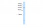 PSD3 antibody - middle region